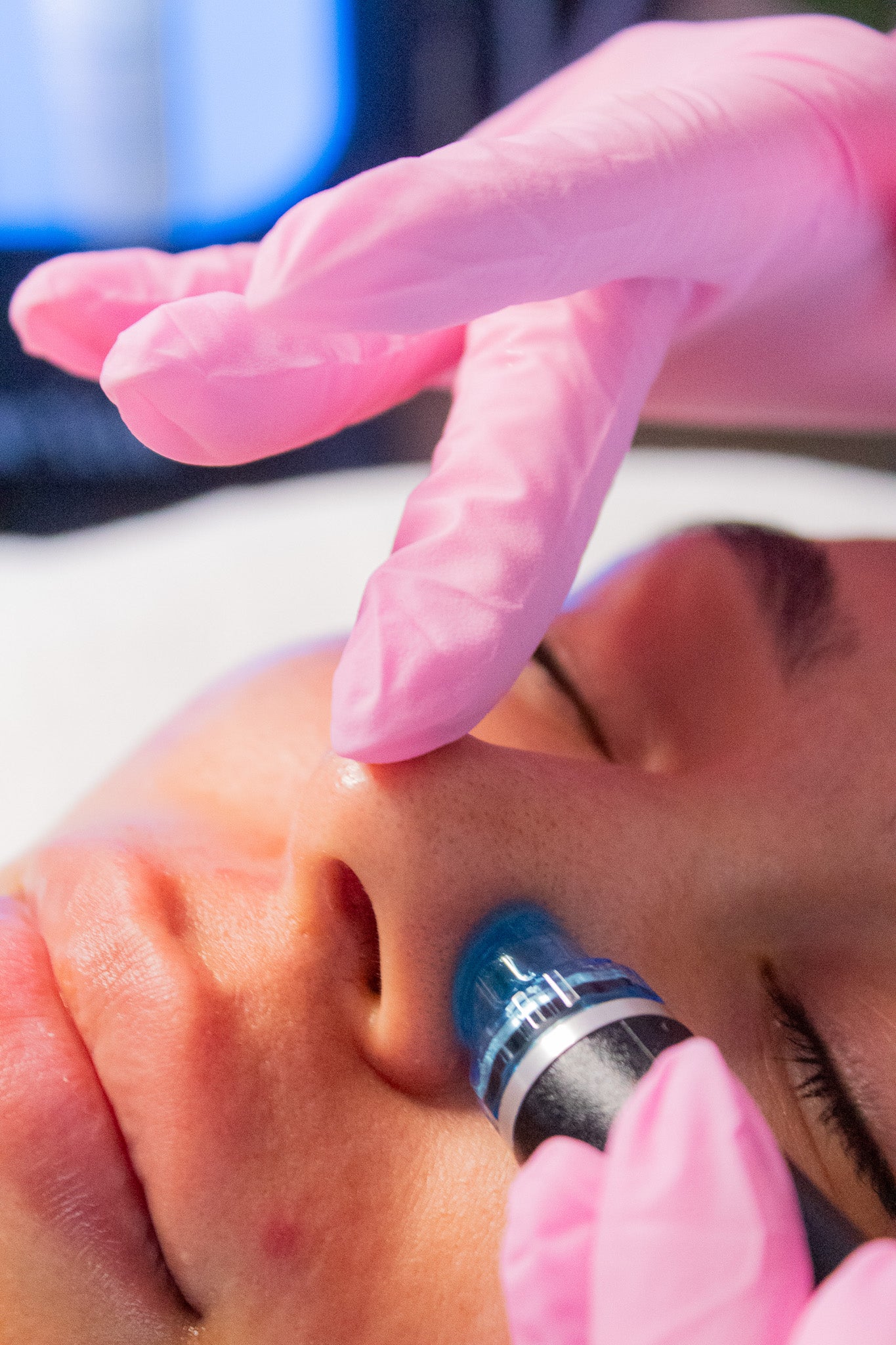 Deluxe Hydrafacial