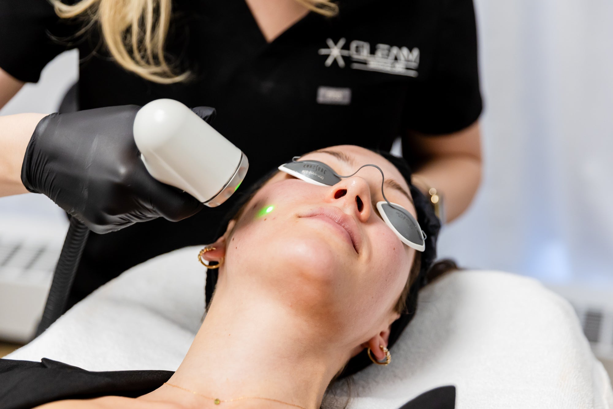 Laser Facials