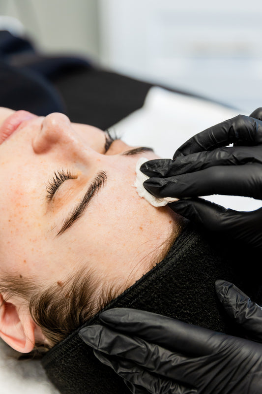 Level 2 Chemical Peel