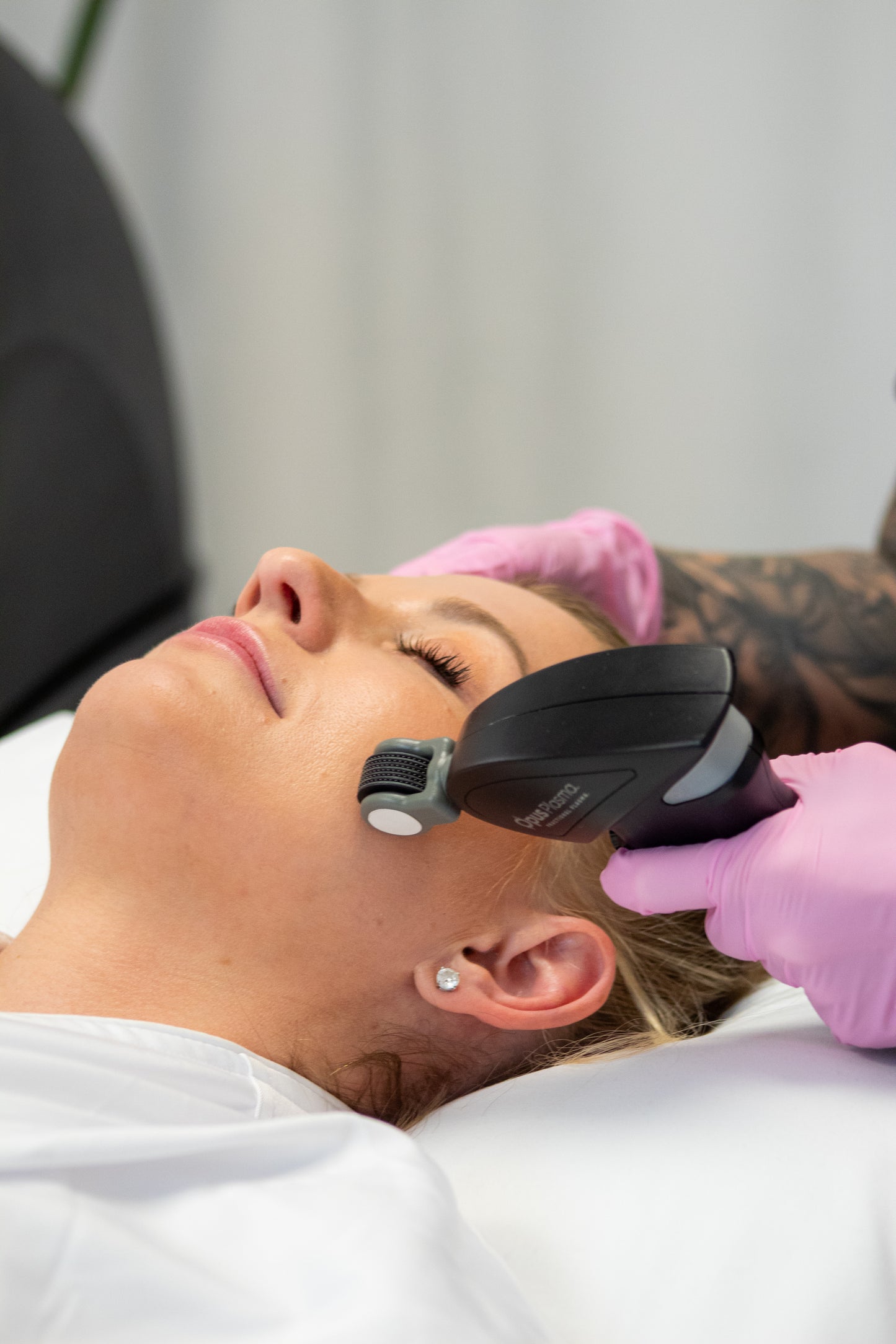 Opus Plasma Resurfacing- Face